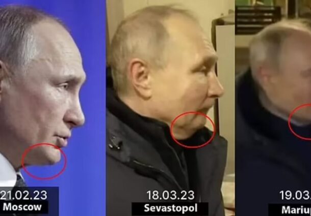 Vladimir Putin, sosii, trei, interventii chirurgicale, supraveghere